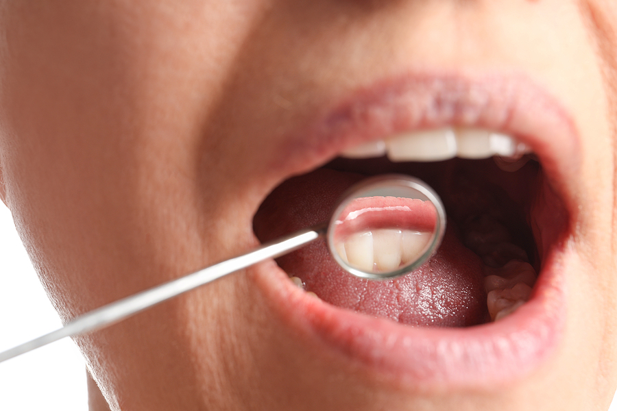 How Important Are Professional Teeth Cleaning Sessions?