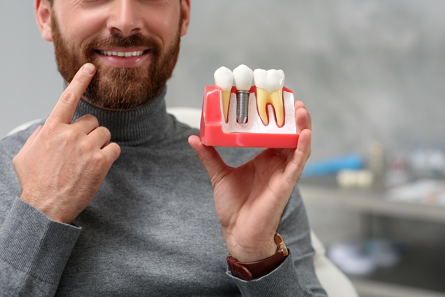 Dental Implants Are the Best Solution for Missing Teeth