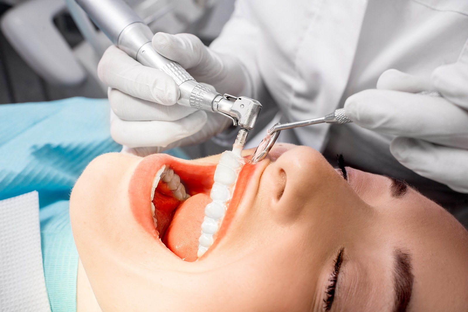 The Importance of Regular Dental Cleanings in Modesto, CA for a Healthy Smile