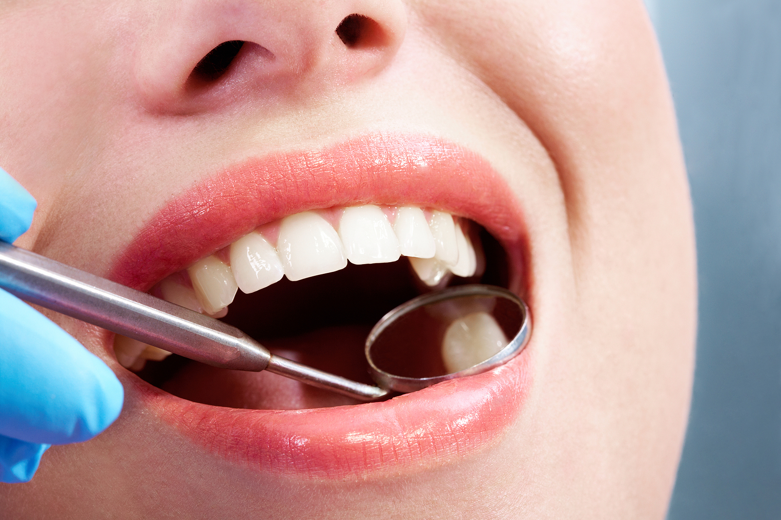 Understanding Dental Fillings: A Comprehensive Guide for Modesto Residents
