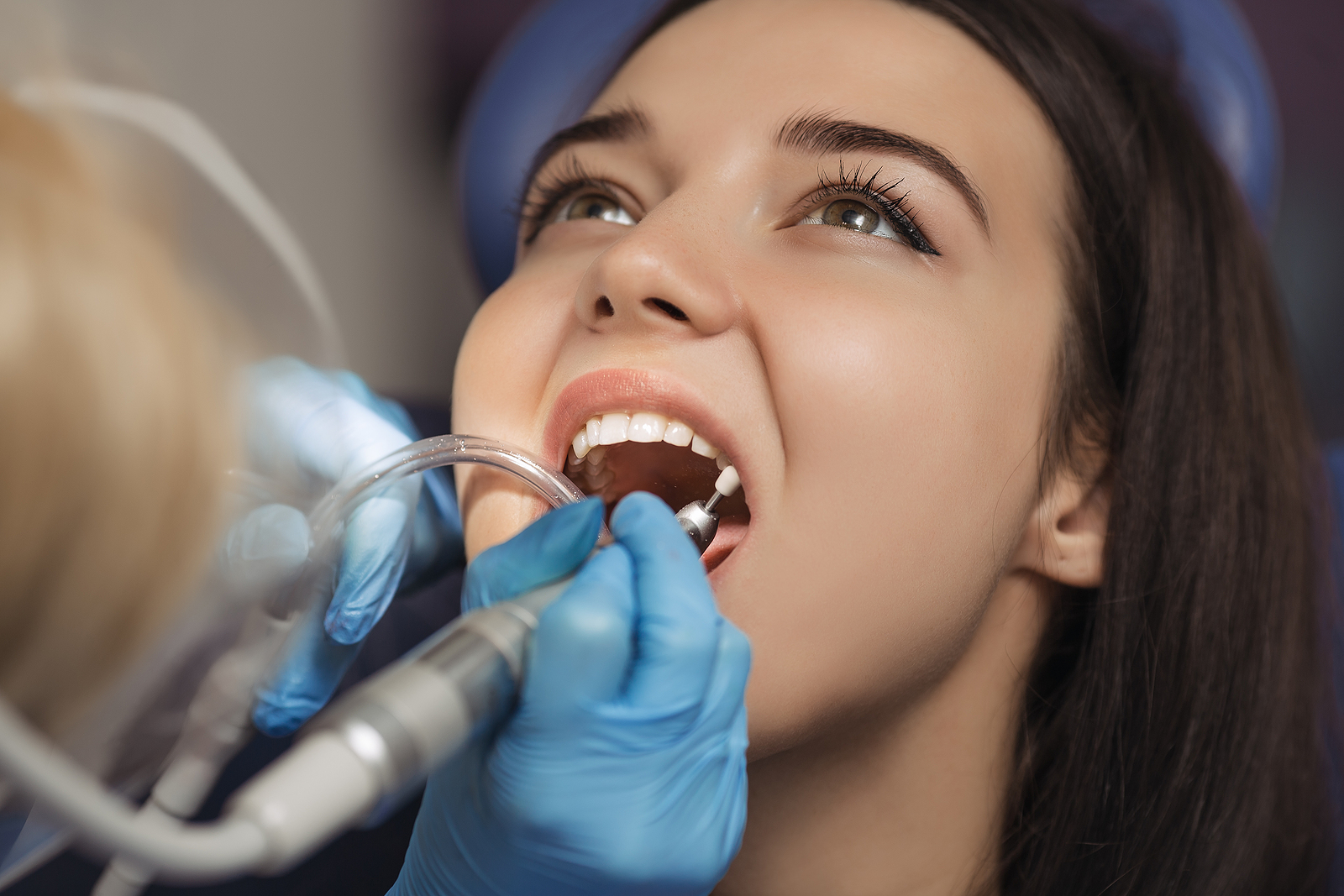Oral Hygiene Tips After Tooth Extraction: Keeping Your Mouth Clean Without Compromising Healing