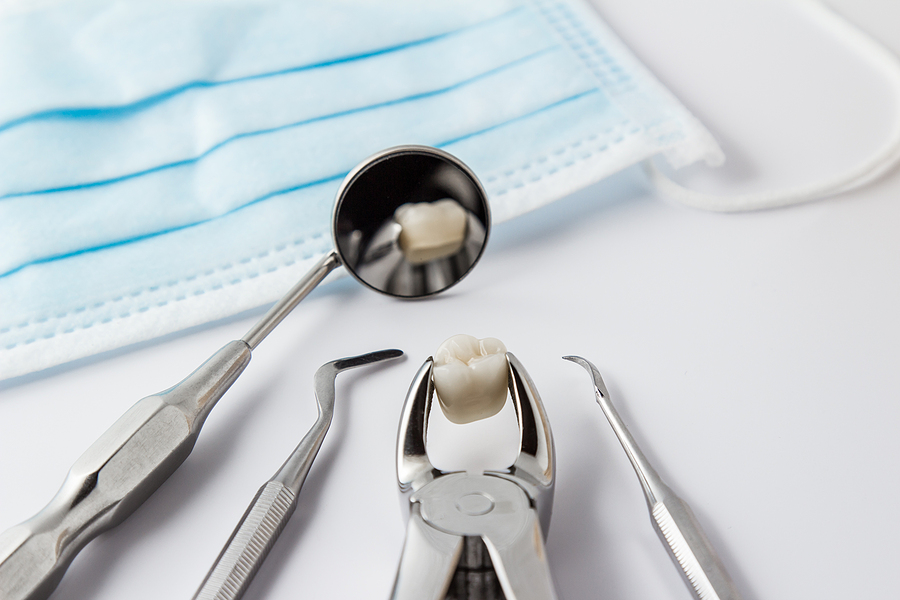 Understanding General Dental Extractions: When and Why They Are Needed