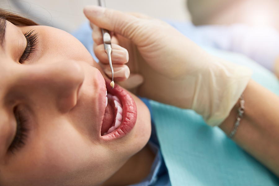 Avoiding Dry Socket: Best Practices for Post-Extraction Care