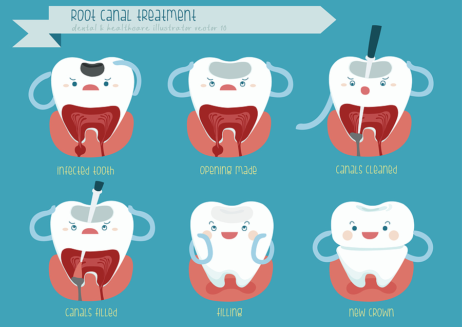 Root Canal Treatment: A Path to Saving Your Smile in Modesto, CA
