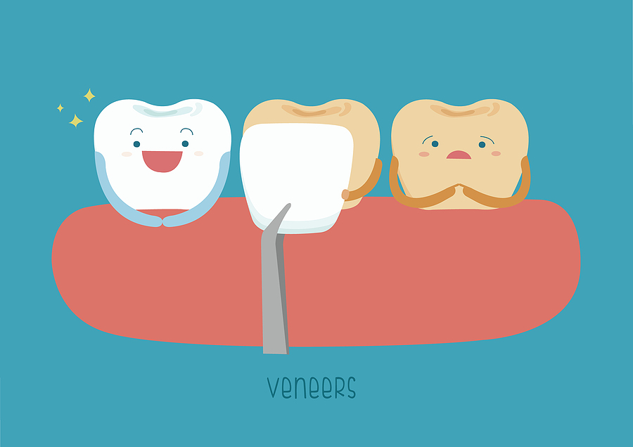 Transform Your Smile with Stunning Veneers in Modesto, CA